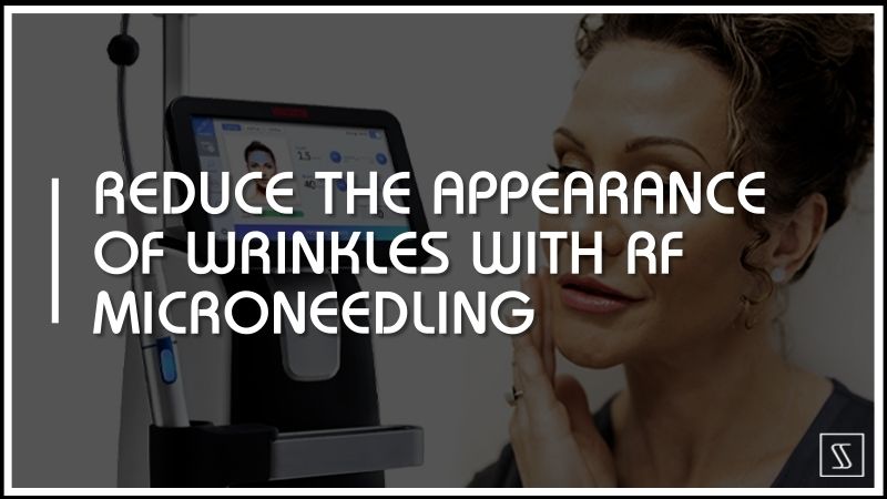 ﻿Reduce The Appearance Of Wrinkles With RF Microneedling