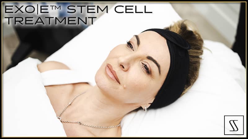 EXO|E™ Skin Revitalizing Complex Stem Cell Treatment